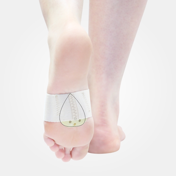 پد متاتارس طب و صنعت